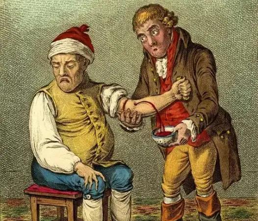 Illustration of bloodletting from the forearm of a man, 1800s.